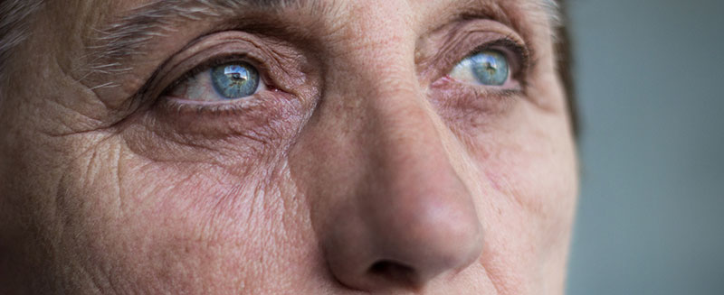 Understanding How Alzheimer’s Disease Affects Vision